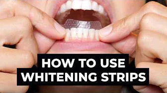 Teeth Whitening STRIPS: The BIG Mistake No One Tells You About 😳