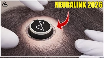 Neuralink Update For 2026: What the Latest Human Trials Actually Show?