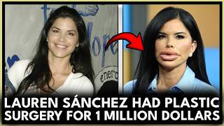 Lauren Sanchez Spent $1 Million on Plastic Surgery… and the Results Shocked Everyone! 👑
