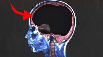 A man asked AI for health advice and it cooked every brain cell