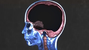 A man asked AI for health advice and it cooked every brain cell