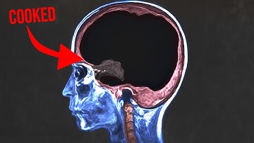 A man asked AI for health advice and it cooked every brain cell