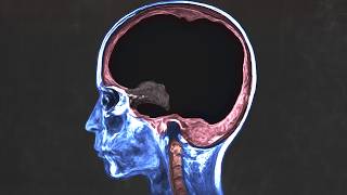 A man asked for AI health advice and every brain cell was cooked